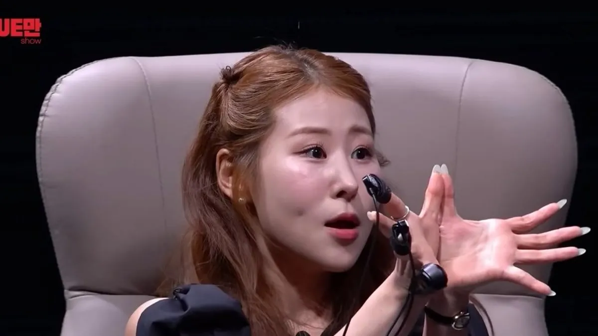 "코에서 우지끈 소리" 박세미, 공연 중 사고로 코 수술 3번 하게 된 사연